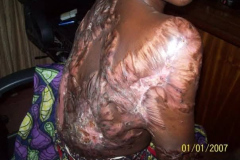 Survivors offering support